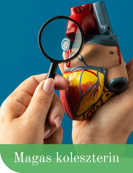 Magas koleszterin